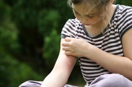 Decât să procesați o mușcătură de țânțari la copil - este important să știți!